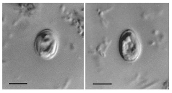 Cryptosporidium oocytes (C. Muris)